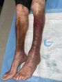 Dermiteocre94.jpg