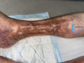 Dermiteocre65.png
