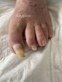 Ongles32.png