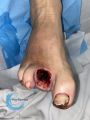 Amputation1.jpg