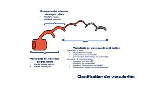 Classification des vascularites 1.jpg