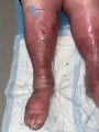 Grosses jambes suintantes40.jpg