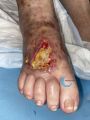 Cou de pied95.jpg