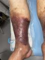 Dermiteocre89.jpg