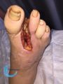 Amputation42.jpg