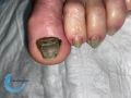 Ongles71.jpg