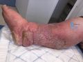 Grosses jambes suintantes30.jpg