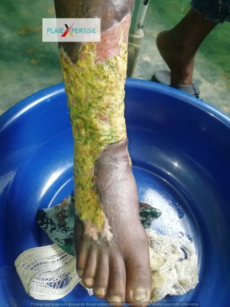 Fichier:Congo Kouilou33.jpg
