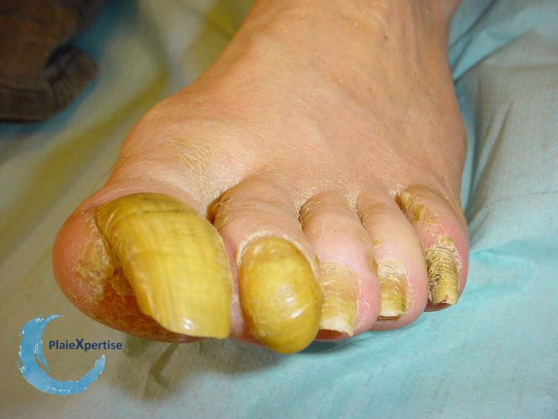 Fichier:Ongles63.jpg