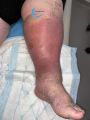 Grosses jambes suintantes43.jpg