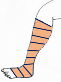 Compression.png