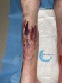 Dermatoporose40.jpg