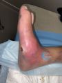 Charcot52.jpg