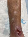 Dermatoporose36.jpg
