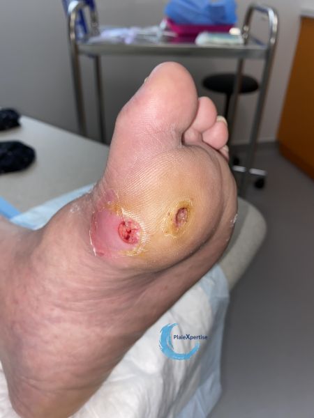Fichier:MPP34.jpg