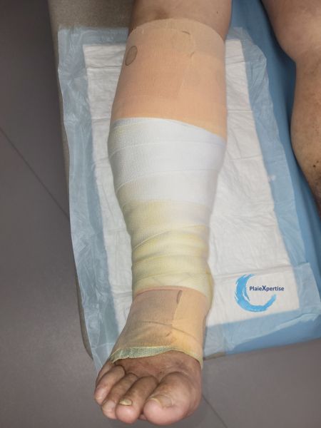 Fichier:Compression EI26.jpg