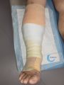 Compression EI26.jpg