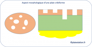 Cribiforme6.png
