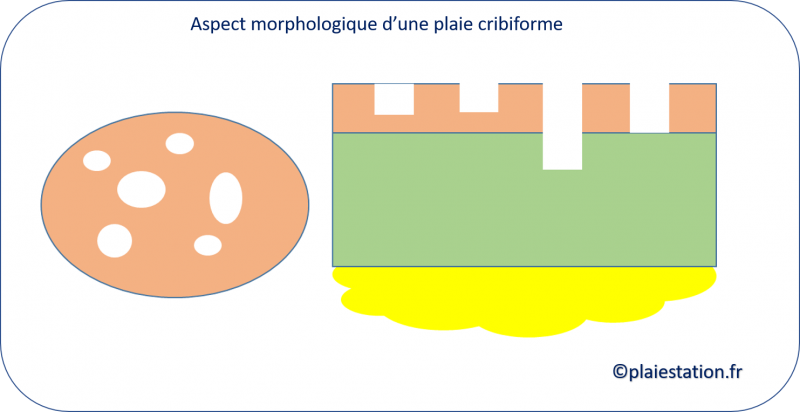 Fichier:Cribiforme6.png