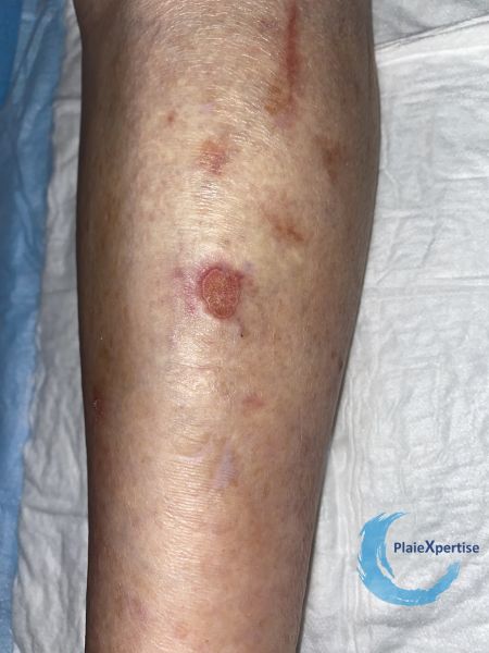 Fichier:Erosions post bulleuses7.jpg