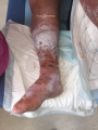 Grosses jambes suintantes24.png