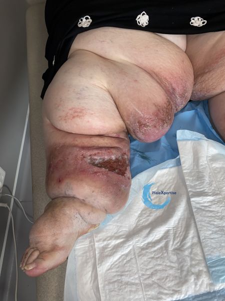Fichier:Lipoed14.jpg