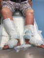 Grosses jambes suintantes11.png