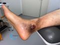 Dermiteocre76.jpg