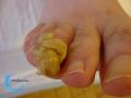 Ongles76.jpg