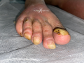 Ongles31.png