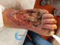 Cou de pied64.jpg