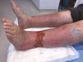 Grosses jambes suintantes34.jpg