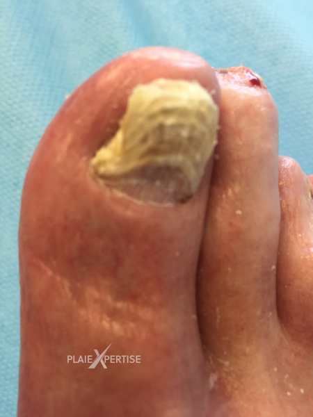 Fichier:Ongles22.png