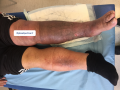 Dermiteocre18.png