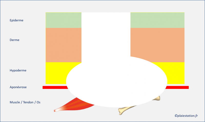 Fichier:Cav5.png