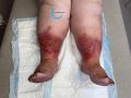 Grosses jambes suintantes27.jpg