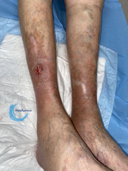 Fichier:Spinoc111.jpg