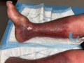 Dermiteocre55.png