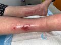 Erosions post bulleuses10.jpg