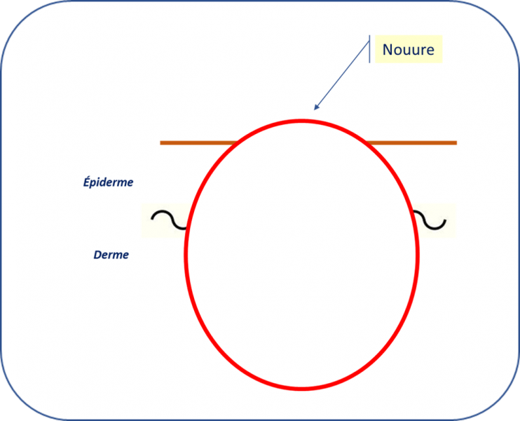 Fichier:Nouure.png