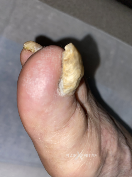 Fichier:Ongles28.png
