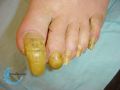 Ongles62.jpg