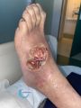 Cou de pied89.jpg
