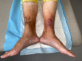 Dermiteocre48.png