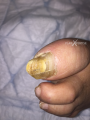 Ongles17.png