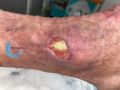 Tendon normal35.jpg