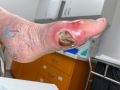 Pied infecté4.jpg