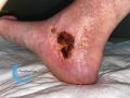 Croûtes36.jpg