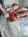 Amputation8.jpg