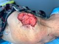 Nodule5.jpg